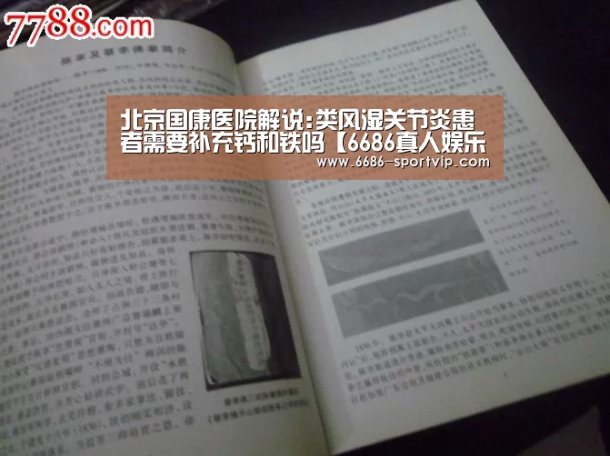 北京国康医院解说:类风湿关节炎患者需要补充钙和铁吗【6686真人娱乐】(图4) 6686体育